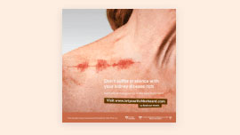  An image of the front of a resource document showing a female shoulder and neck with a noticeable, graphical representation of itchy skin