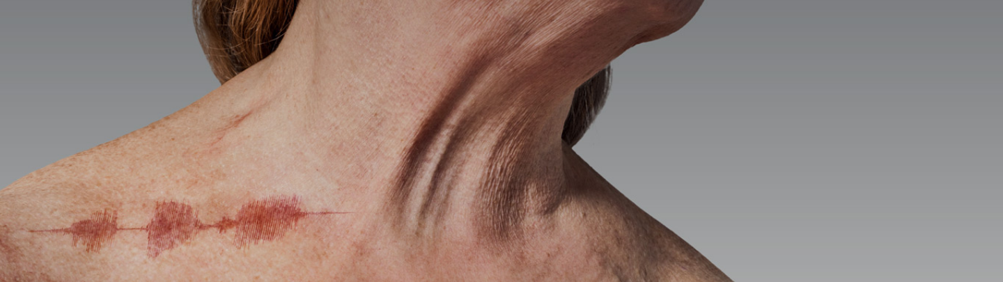 A close up of a woman's neck and shoulders with a visible graphical representation of uncomfortable, itchy skin.